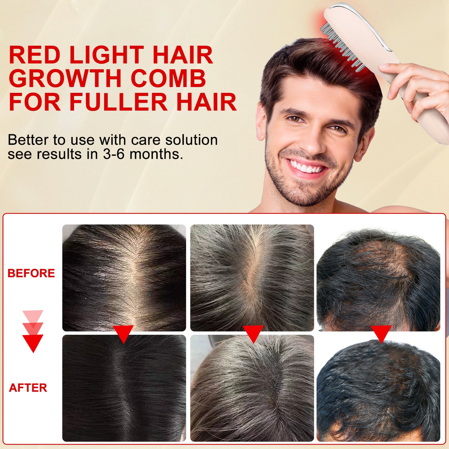 Cool-i ® 5-in-1 Kopfhaut-Massagebürste – Mit 4-Farben-LED + Infrarot für Haarwachstum, EMS, Vernebelung, Ionen & Massage für gesunde Kopfhaut und kräftiges Haar