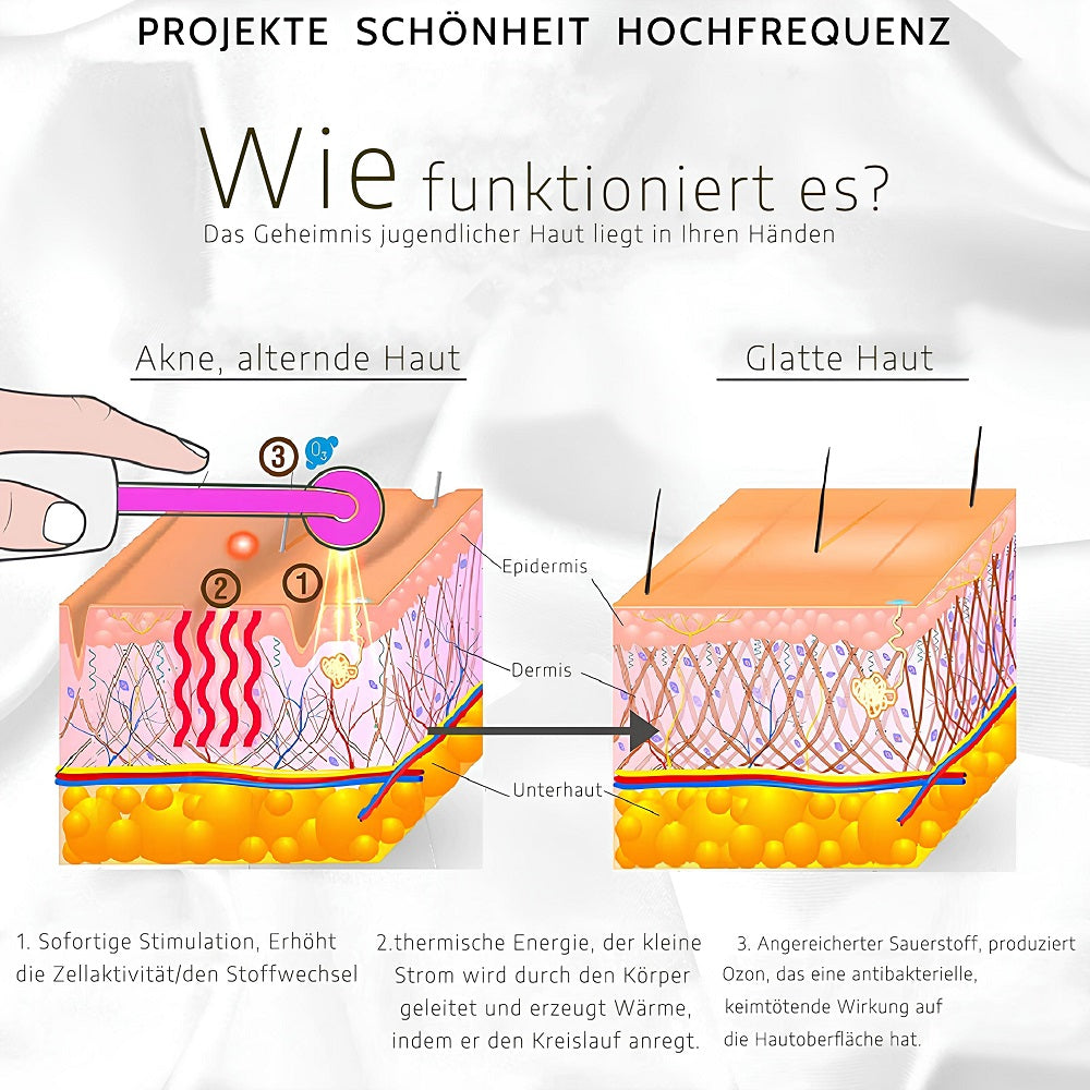 Funktionsweise des COOL-i Hochfrequenzgeräts – Hochfrequenzenergie zur Zellstimulation und verbesserten Hautstruktur