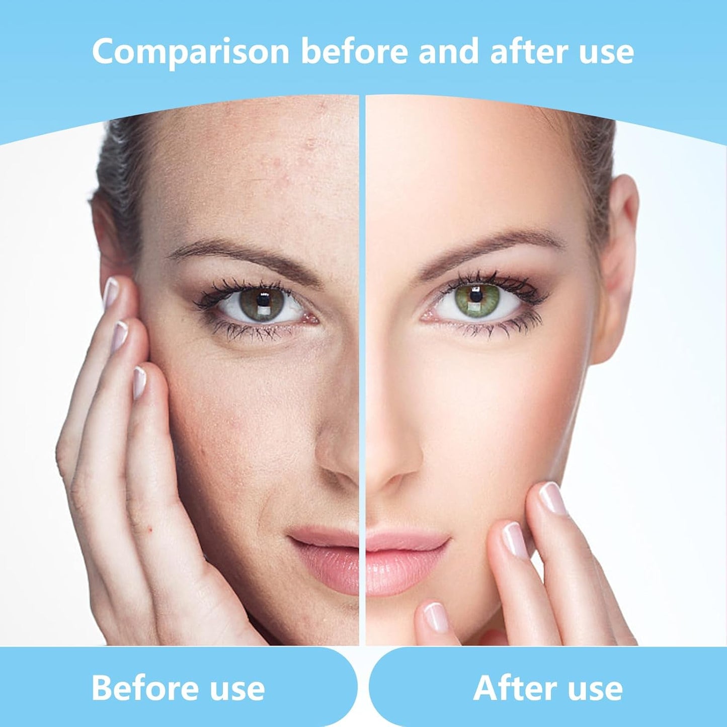 Cool-i® 20 Stk. Microneedling-Nadeln – 36-Pin Ersatzaufsätze, einzeln steril verpackt – kompatibel mit Microneedling Pen zur Hautpflege & Porenverfeinerung.(V2)