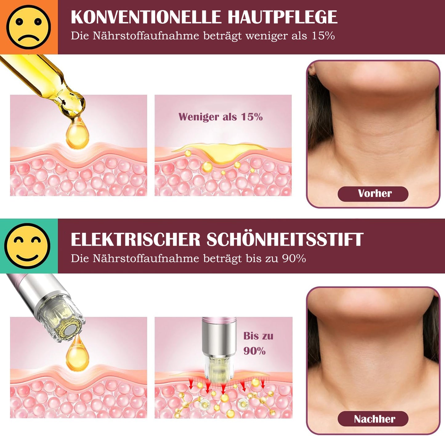 Cool-i ® Microneedling Pen Elektrisch, Wiederaufladbarer Kabelloser Derma Pen mit 5 Stufen, Mikronadel-Stift für Narben, Falten, Dehnungsstreifen, Akne & Hautverjüngung