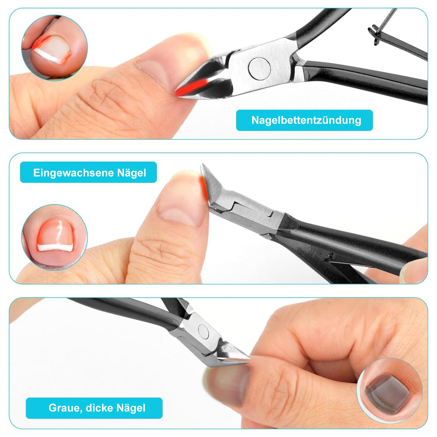 Profi Nagelzange aus Edelstahl – Präzisions-Fußnagelschere für eingewachsene Zehennägel mit rutschfestem Griff