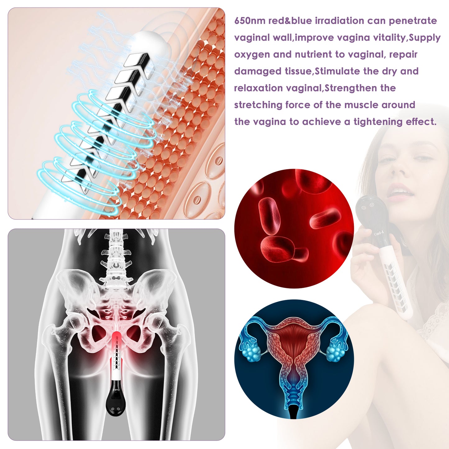 Cool-i ® Vaginaltrainer & Intimtherapie: Tragbares Gerät mit Rot- & Blaulicht, EMS, ideal für Scheidenentzündungen, Beckenbodenstärkung, Wechseljahre & nach Geburt.