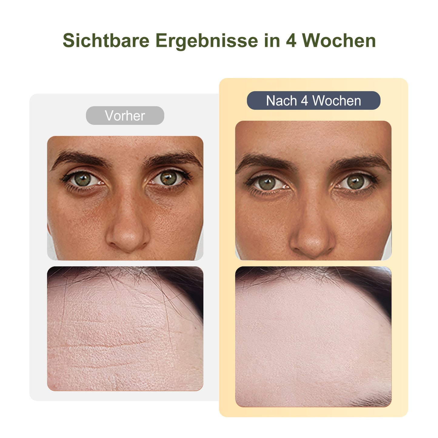COOL-i® 2MHz RF & EMS Gesichtsmassagegerät – 6-in-1 Hautverjüngung mit Ultraschall, Licht & Kühlmodus