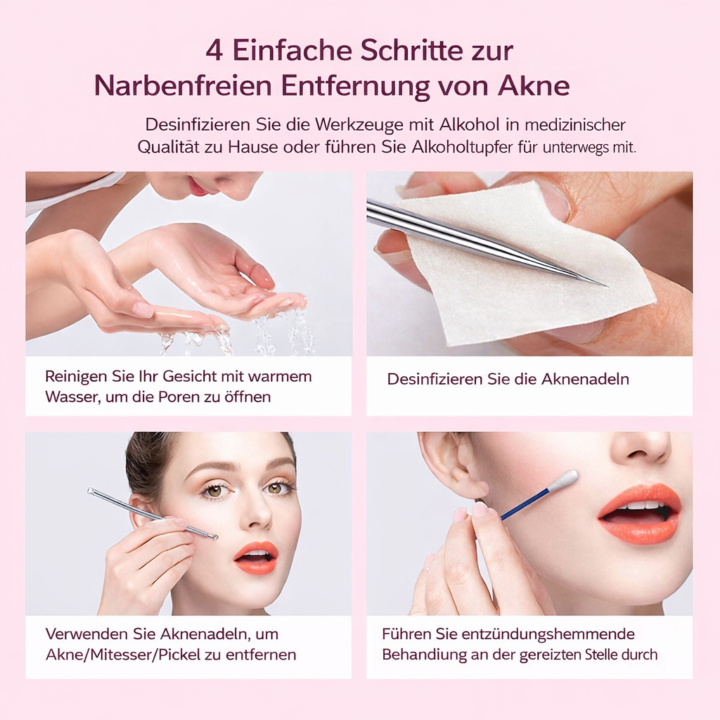 Mitesserentferner,4er Mitesserentferner Komedonenquetscher Set